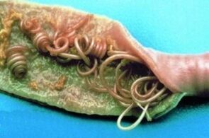 Στρογγυλά σκουλήκια