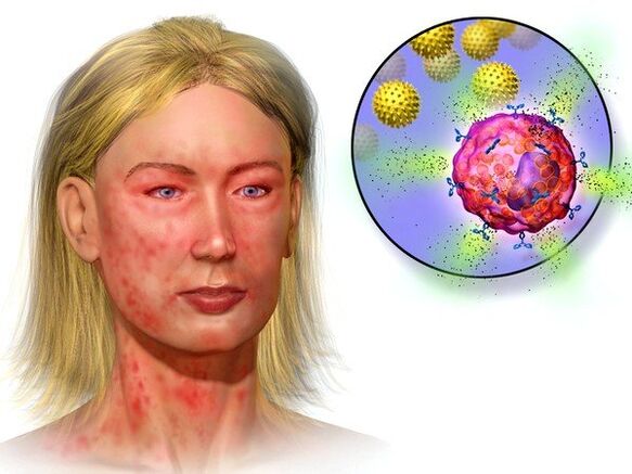 εχινόκοκκους και συμπτώματα της παρουσίας τους στο σώμα